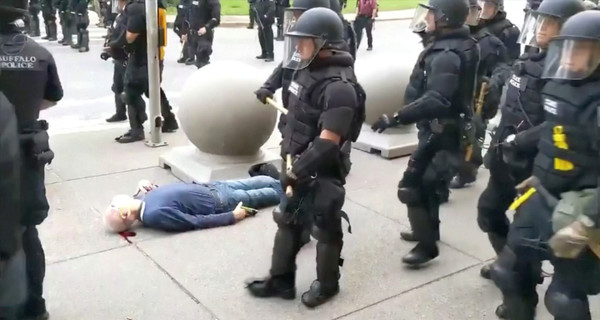 На протестах в США полицейские толкнули 75-летнего мужчину – он попал в больницу
