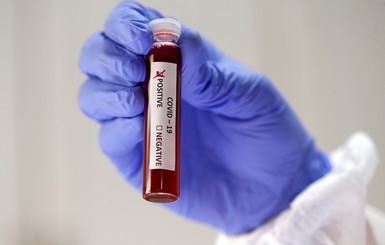В Минздраве рассказали, почему коронавирус в Украине не лечат плазмой крови переболевших