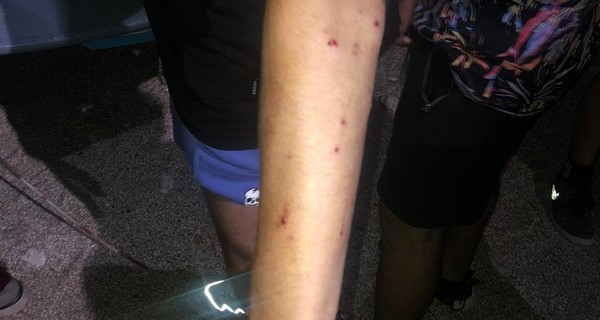 В Одессе дачник стрелял в молодежь, которая громко отмечала день рождения