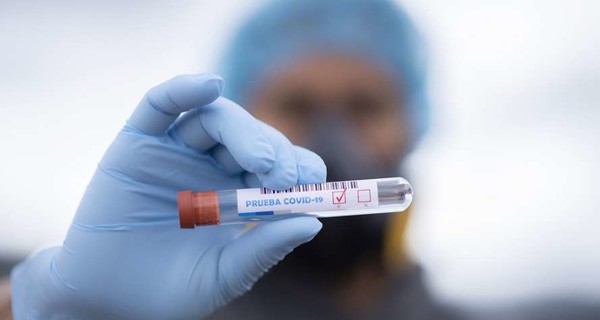 ВОЗ: Инцидентность коронавируса в Украине выше, чем в Европе