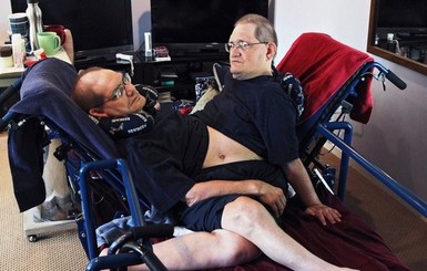 Умерли старейшие в мире сиамские близнецы Ронни и Донни: им было 68 лет    