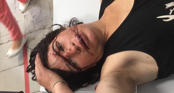 Геращенко заявил, что в Днепре задержали мужчину, избившего девушку на глазах прохожих