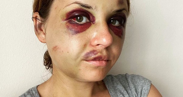 Избитая в поезде журналистка: Сын ходит к психологу и меня тоже боится 