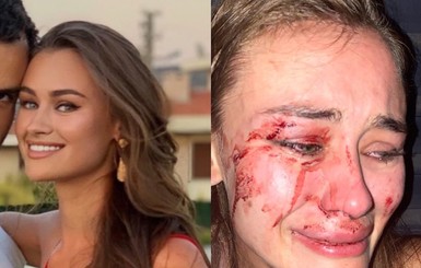 Украинская модель Дарья Кирилюк ответила на появившееся в сети видео с нападением на нее 