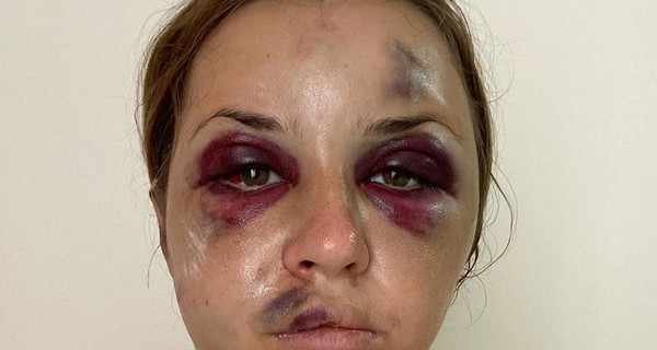 Криклий сообщил, что работники поезда, где напали на журналистку, пытались скрыть ЧП и коррупцию