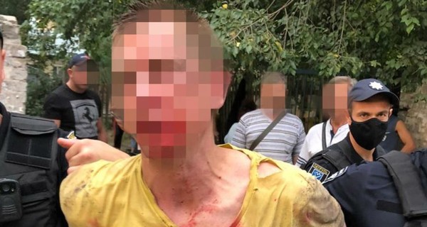 В Днепре задержали мужчину, который бросил гранату в прохожих