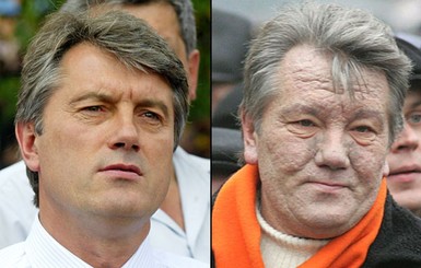 Тайна 12 генпрокуроров: кто отравил Виктора Ющенко