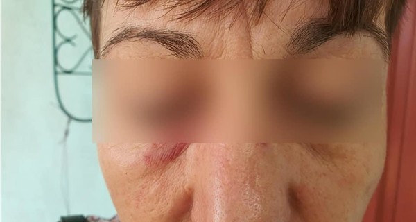 В Сумах пассажирка троллейбуса избила кондуктора из-за медицинской маски