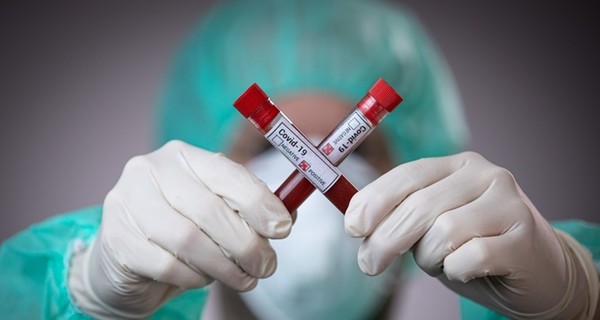 В Украине установлен антирекорд по смертности от коронавируса