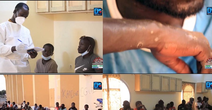 Заподозрили что-то токсичное: в Сенегале сотни рыбаков покрылись болезненной сыпью