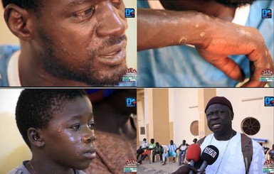 Загадочная болезнь рыбаков в Сенегале таинственно исчезла