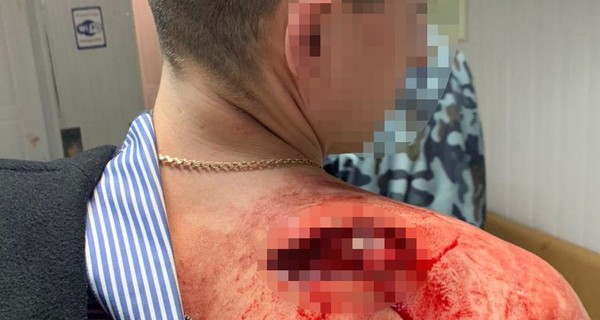 Стрельба у ресторана в Днепре: одним из напавших на охранника был пьяный патрульный