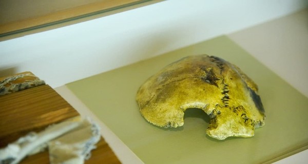 В Москве выставили напоказ часть черепа Гитлера