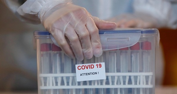 Коронавирус в Украине пошел на спад: за сутки заболели 8325 человек