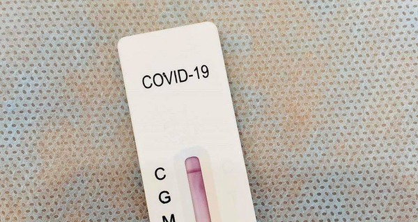 В МОЗ разъяснили, кто и где может пройти тестирование на коронавирус бесплатно