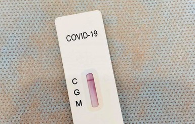 В МОЗ разъяснили, кто и где может пройти тестирование на коронавирус бесплатно