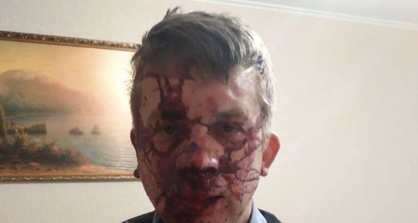 В Запорожье четверо неизвестных избили депутата облсовета 