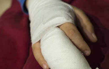 Во Львовской области мальчик лишился пальцев на руке из-за взрыва петарды