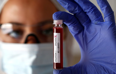 В Минздраве рассказали, надо ли делать тест на антитела перед прививкой от коронавируса
