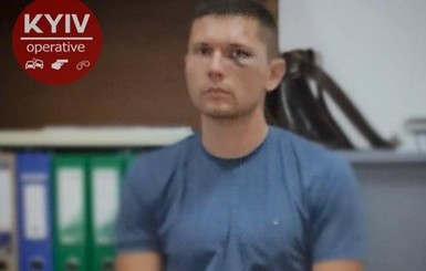 Уволили сотрудника УГО, который избил танцора Нади Дорофеевой