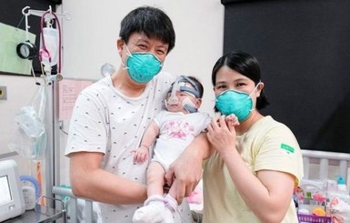 Весила как яблоко: в Сингапуре врачи больше года спасали самую маленькую новорожденную в мире