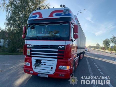 На Житомирщині вантажівка збила дівчинку на пішохідному переході: дитина в реанімації