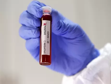 У Чехії виявили новий варіант Дельта-штаму коронавірусу