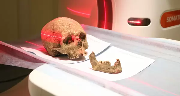 На Тернопіллі відсканували череп, щоб з'ясувати, як виглядав місцевий житель три тисячі років тому
