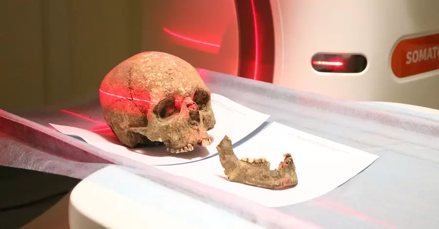 На Тернопольщине отсканировали череп, чтобы выяснить, как выглядел местный житель три тысячи лет назад