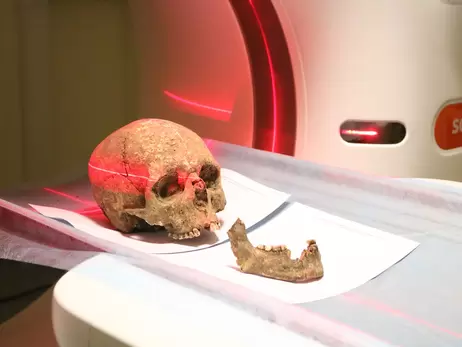 На Тернопіллі відсканували череп, щоб з'ясувати, як виглядав місцевий житель три тисячі років тому