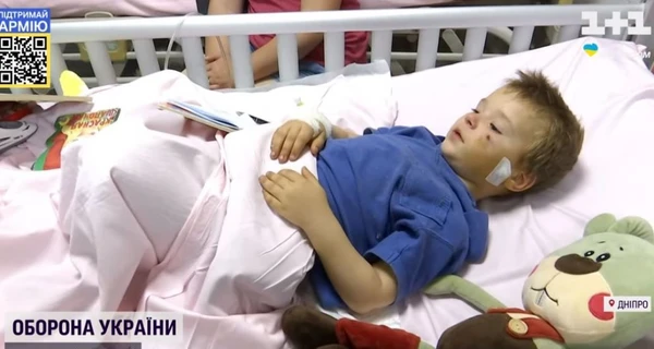 У Дніпрі врятували хлопчика, який отримав численні поранення, коли біг до укриття