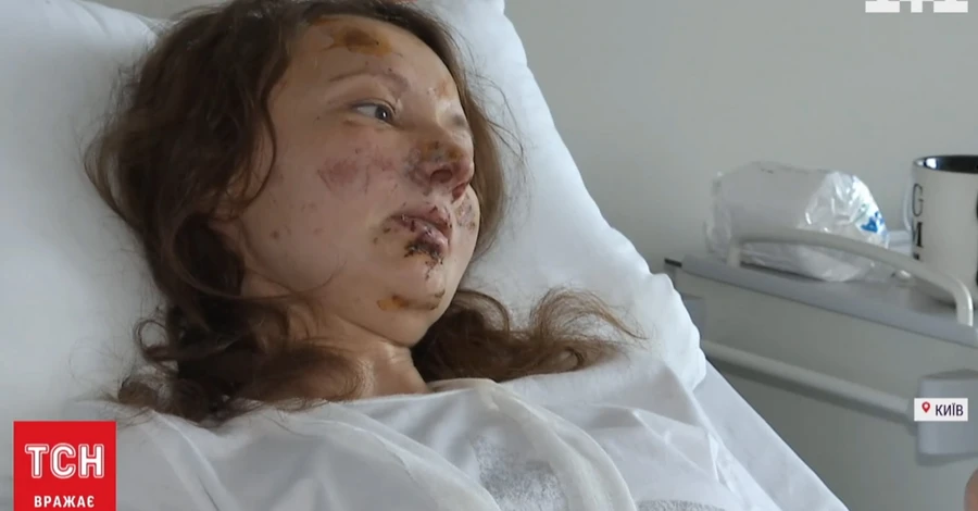 Пострадавшую от российского обстрела киевлянку перевели в палату дочери