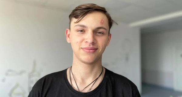 Львівські медики врятували хлопця, який підняв замінований предмет у Святогірську