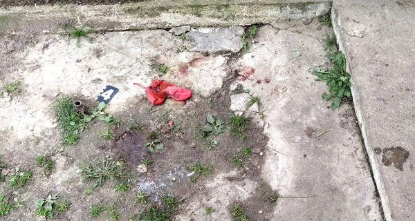 У Рівненській області собака загриз насмерть немовля