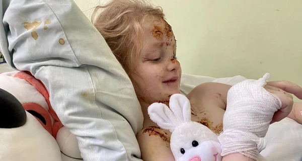 Врачи спасают 6-летнюю девочку из Херсона, которую отец достал из-под завалов здания 