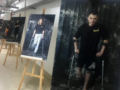 Протези для незламних: у львівській лікарні відкрили сучасну майстерню