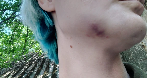 Ужгородская журналистка заявила, что ее избил работник военкомата