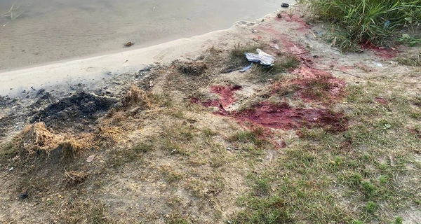 В больнице умер еще один ребенок, попавший под обстрел россиян в Константиновке