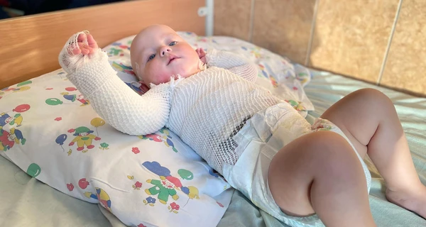 Медики спасают младенца, который опрокинул на себя чайник и обжег четверть поверхности тела