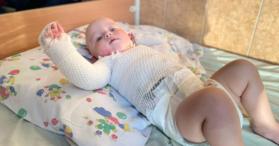 Медики рятують немовля, яке перекинуло на себе чайник та обпікло чверть поверхні тіла