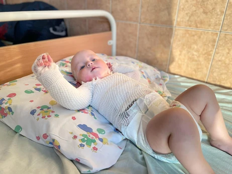 Медики спасают младенца, который опрокинул на себя чайник и обжег четверть поверхности тела