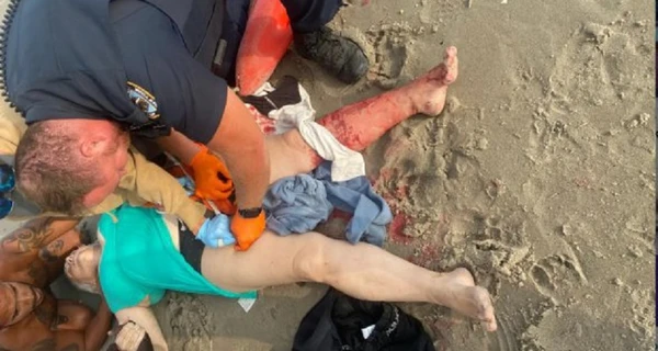 На пляже в США спасли украинку, на которую напала акула