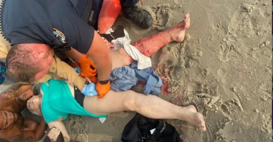 На пляже в США спасли украинку, на которую напала акула