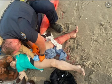 На пляжі в США врятували українку, на яку напала акула