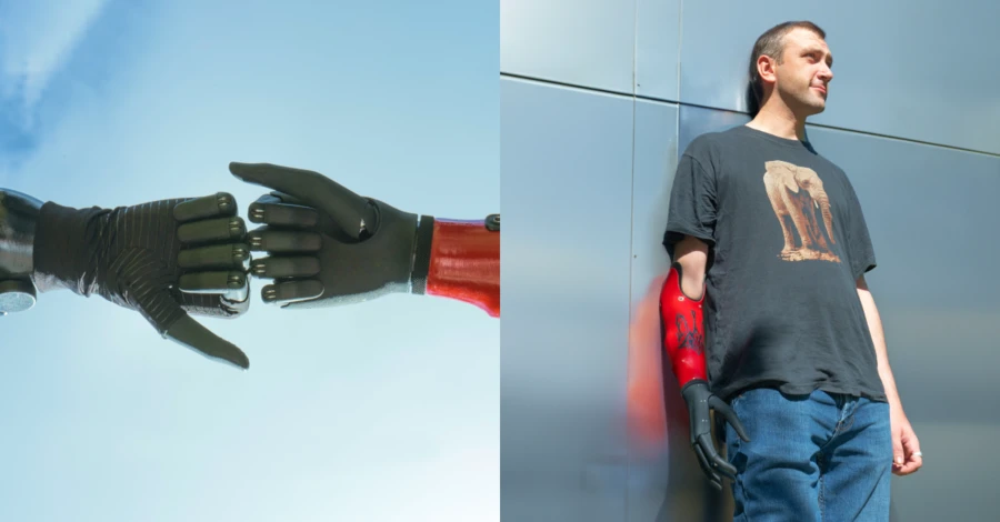 Факт. Двое военных получили бионические руки Esper Bionics от «Фундации Течия»