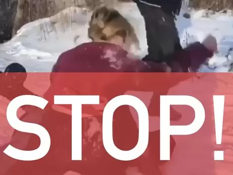В Киевской области во время драки девушка-подросток получила удары ногой по голове – реакция местных властей 