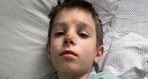 На Киевщине ребенка столкнули с высоты, директор и медсестра гимназии пытались скрыть ЧП