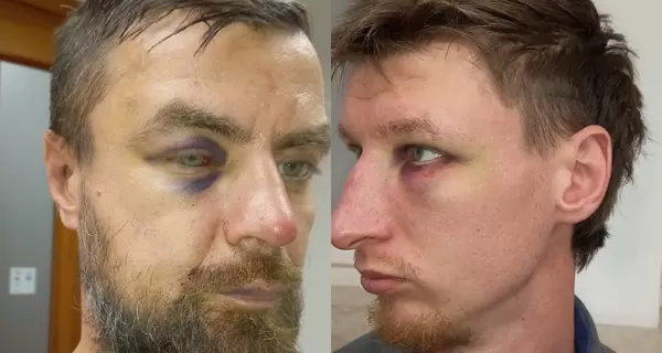 Два украинца заявили, что их избила полиция Варшавы