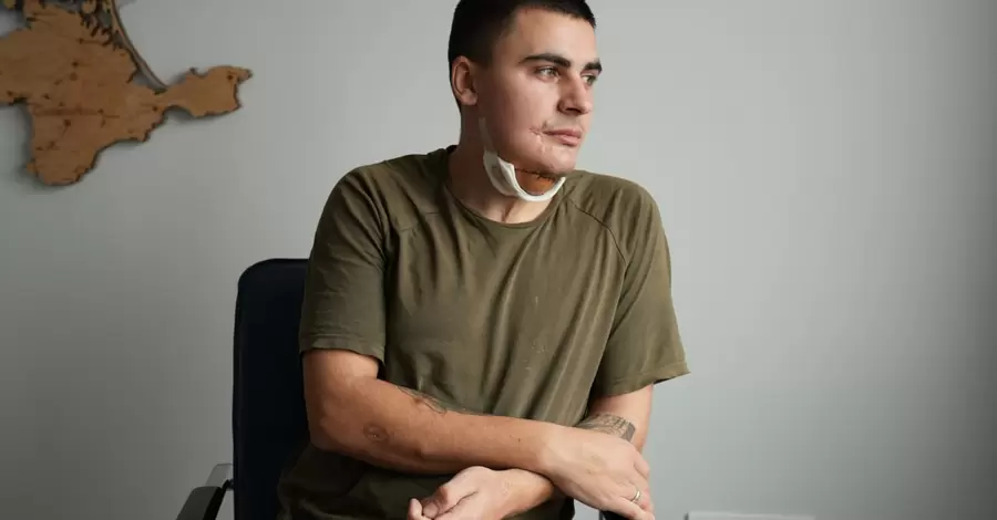 У Львові медики виконали надскладну операцію з реконструкції обличчя воїну