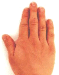 Гениального спортсмена видно по пальцам 